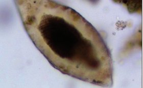 Egg_pre_historic_schistosoma