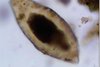 Egg_pre_historic_schistosoma